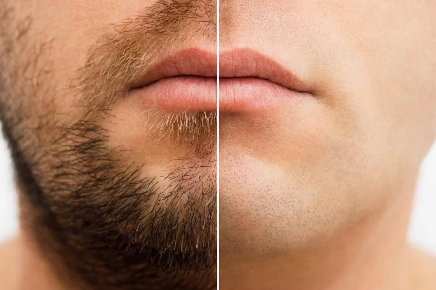 Как удалить бороду и усы с фото