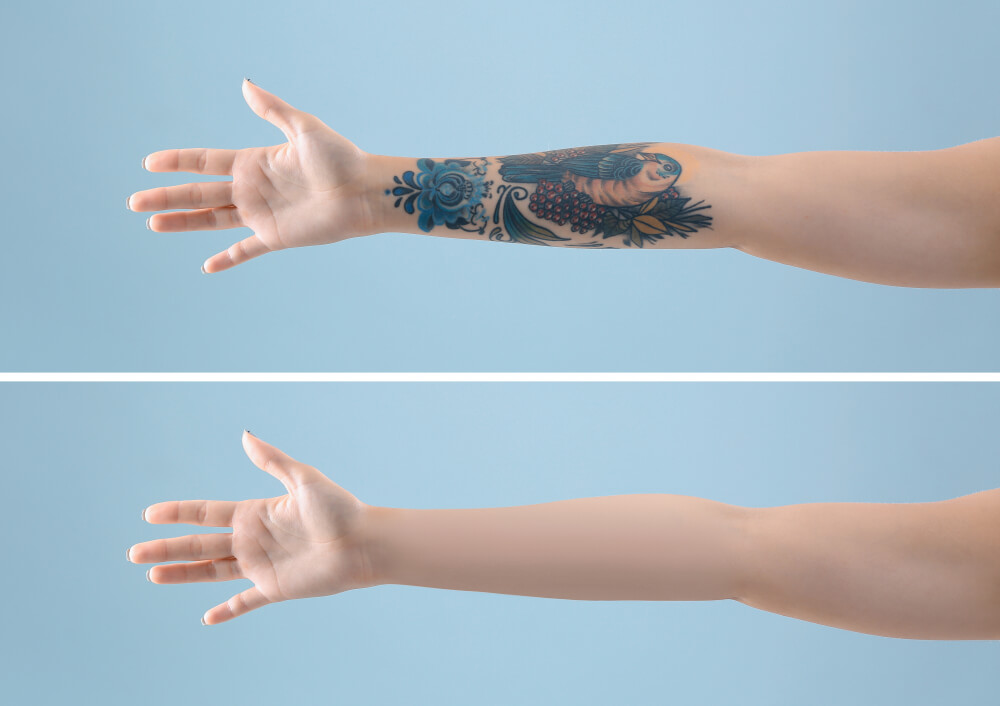 App to cover tattoos in pictures