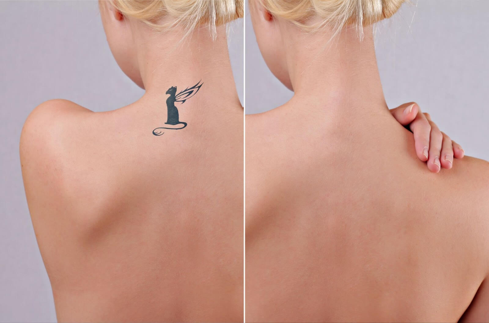 Tattoo Removal App — Remove Tattoos in your Photos online